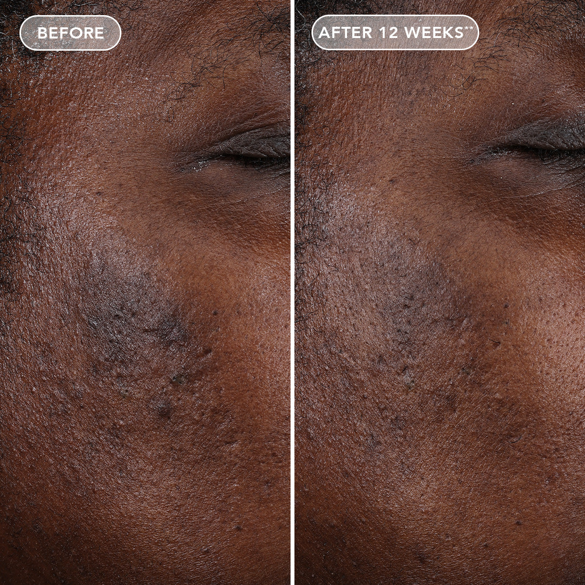 AGELESS+ retinol pure liquid retinol 0.75%