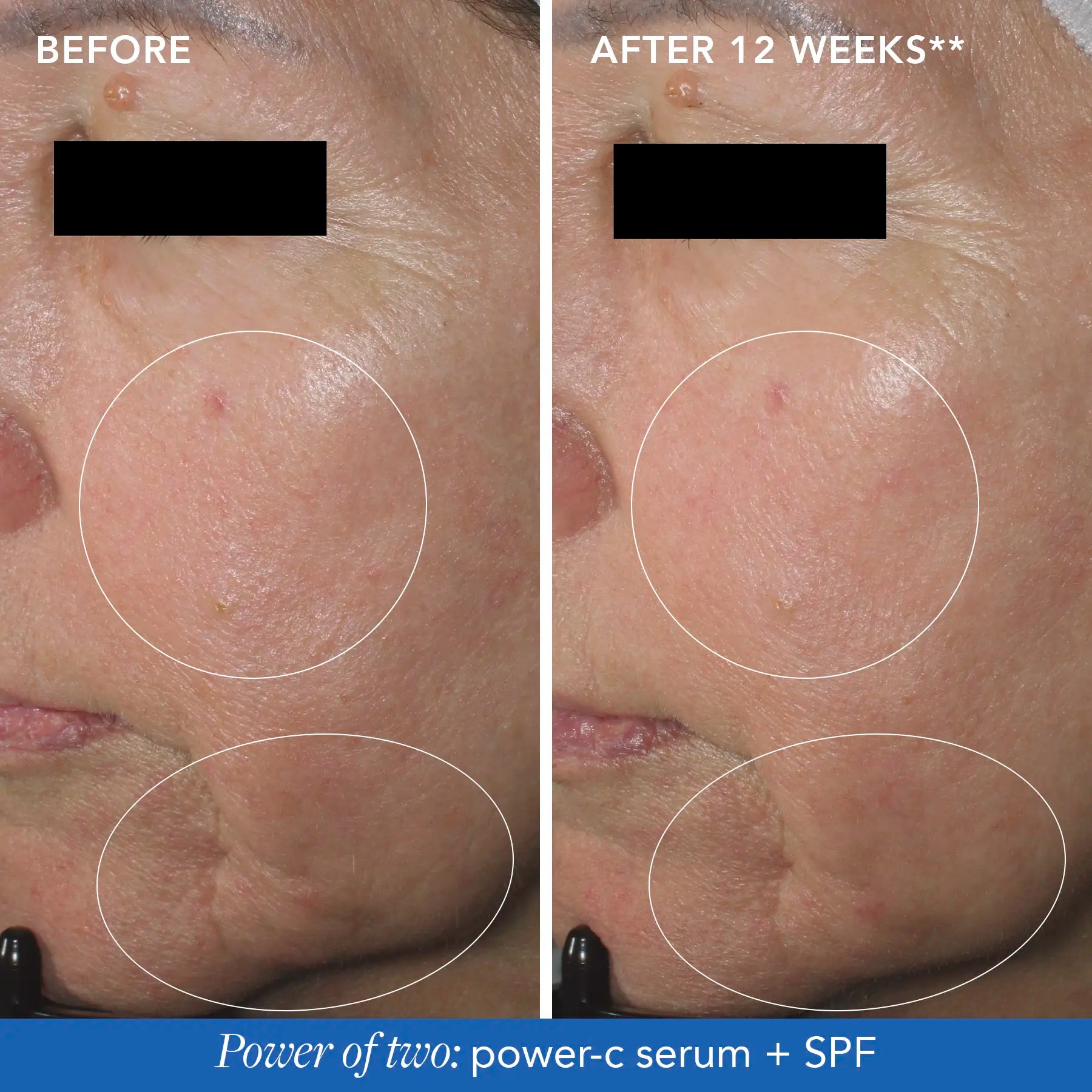 before and after images of product usage