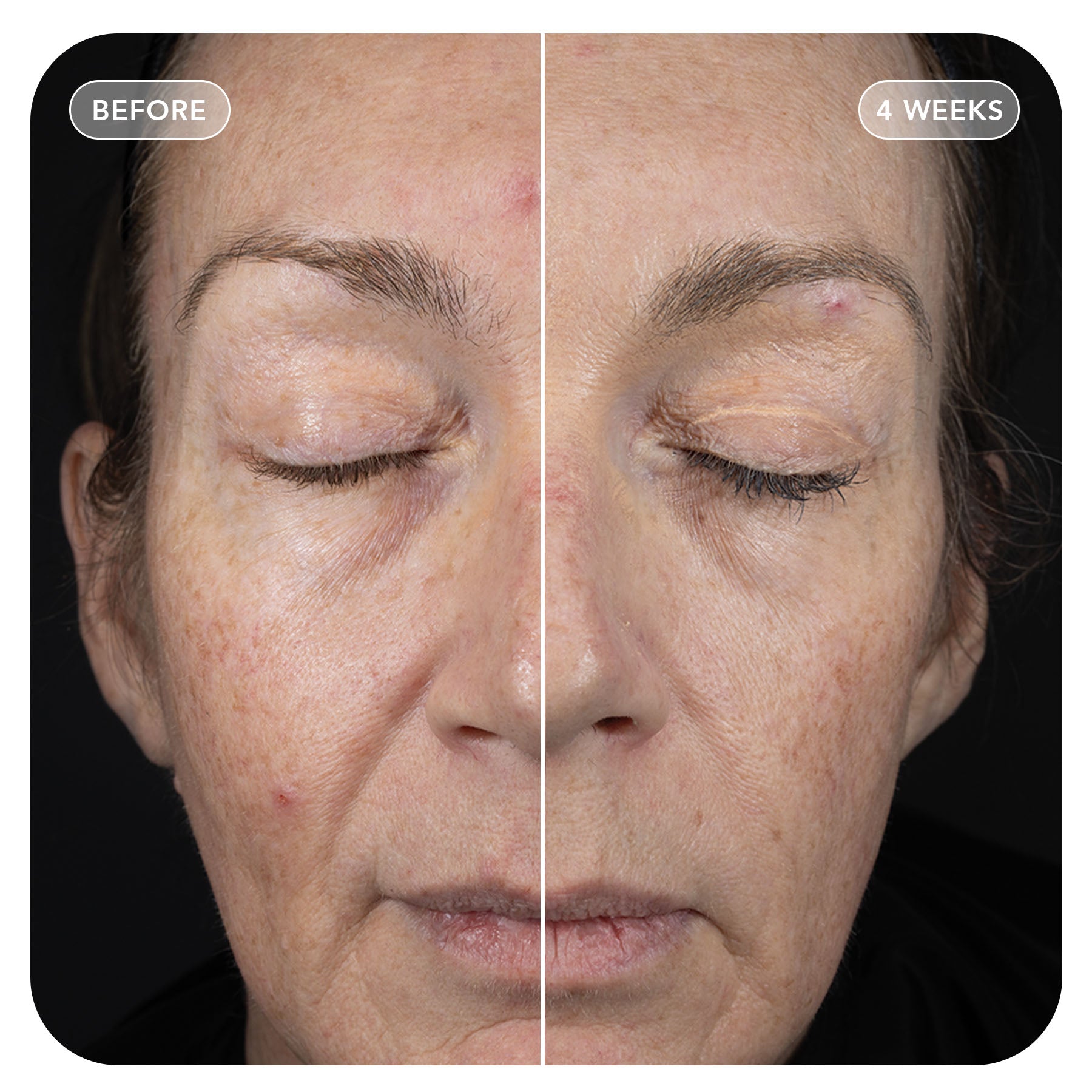 VOL.U.LIFT™ GLP-1 4D Skin Rebound Complex (tester)