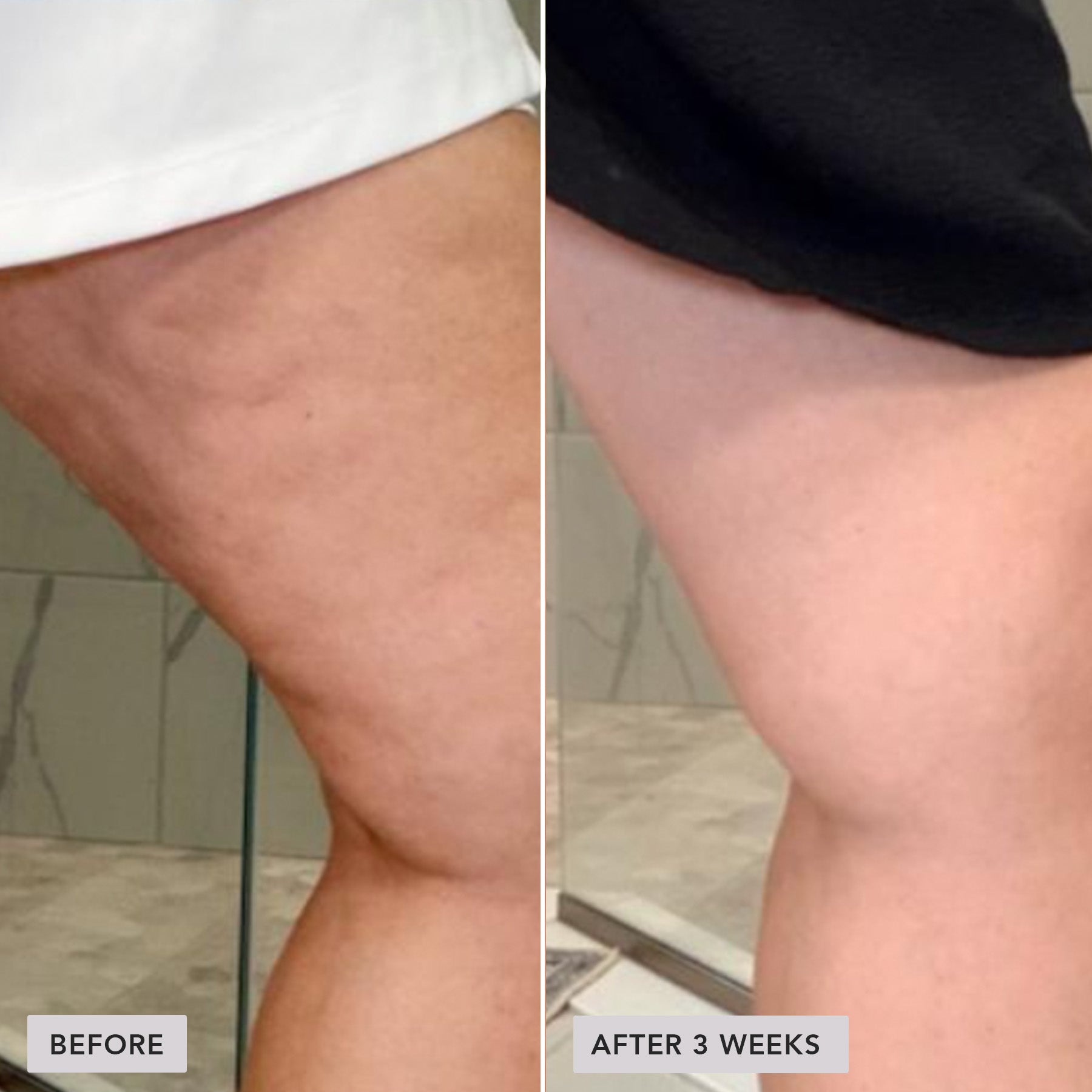 Before-and-after comparison of a person's upper thigh and hip area, showing skin texture and tone improvement after 3 weeks. The left side is labeled 'BEFORE' and the right side 'AFTER 3 WEEKS'.