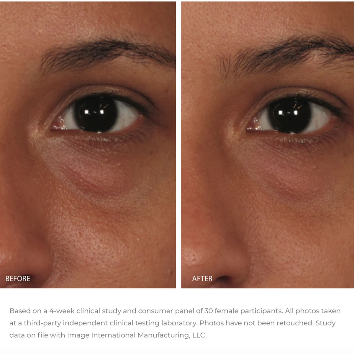 ORMEDIC® balancing eye lift gel
