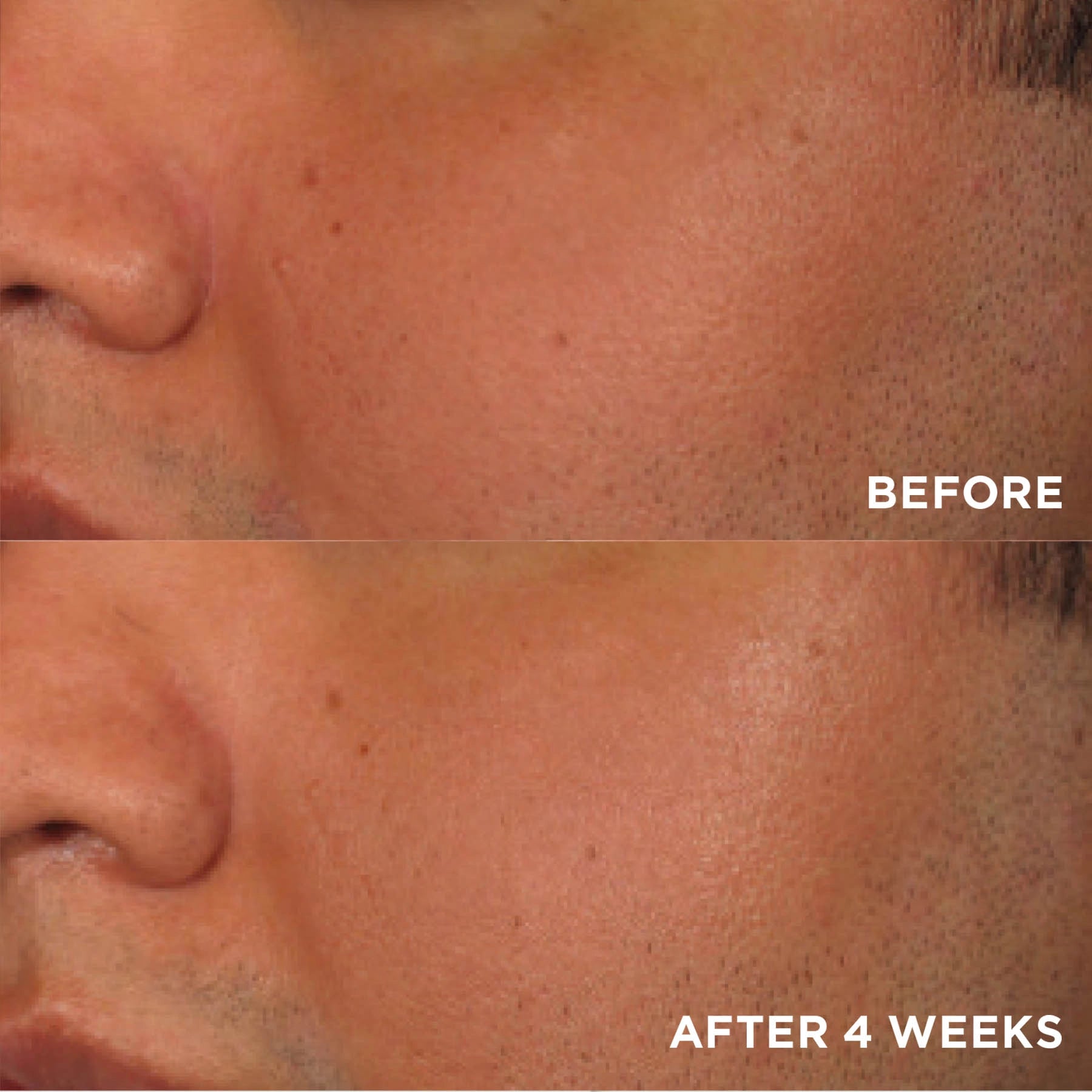 Limited Edition Brightening Boost Bundle