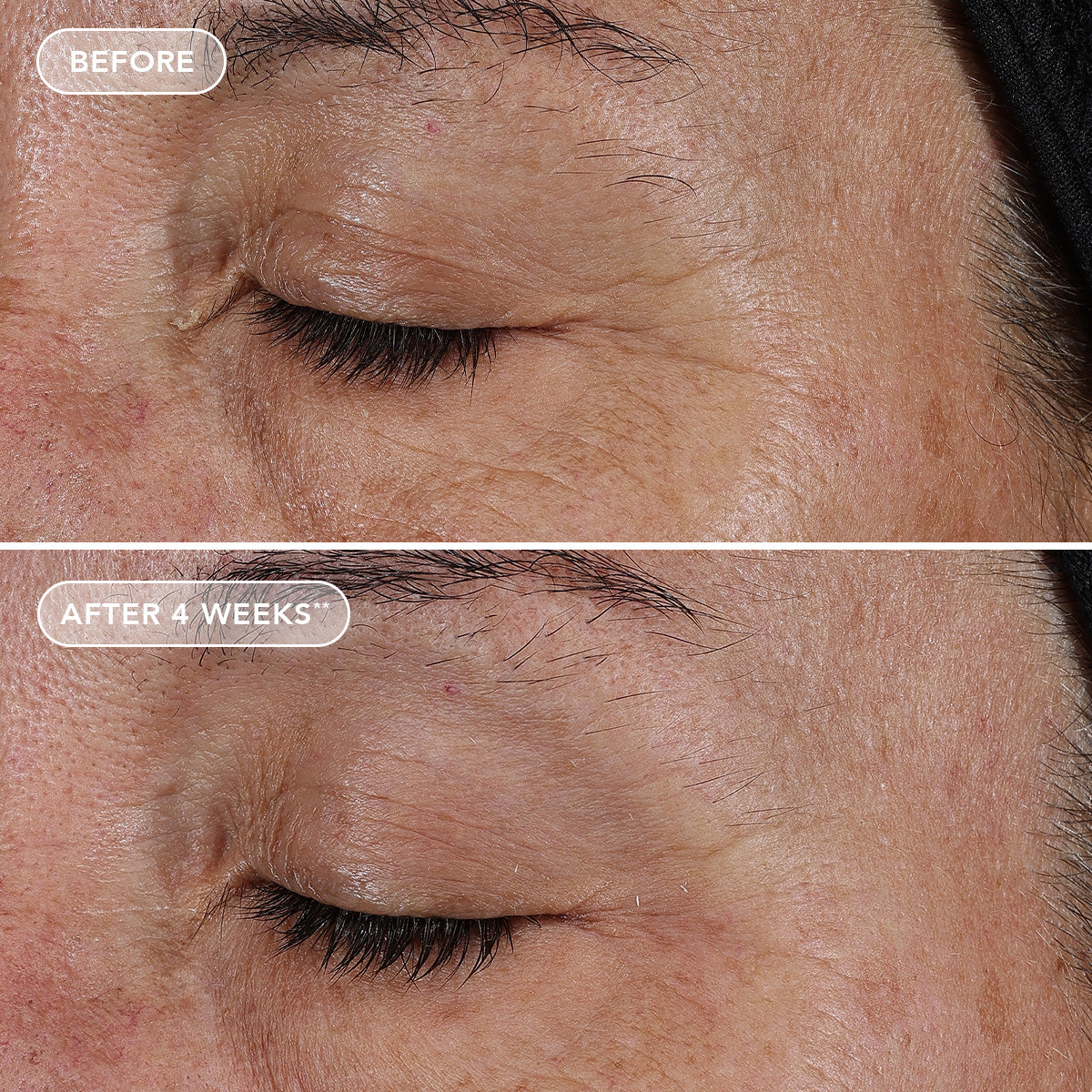 AGELESS+ retinol pure liquid retinol 0.1% (travel-size)