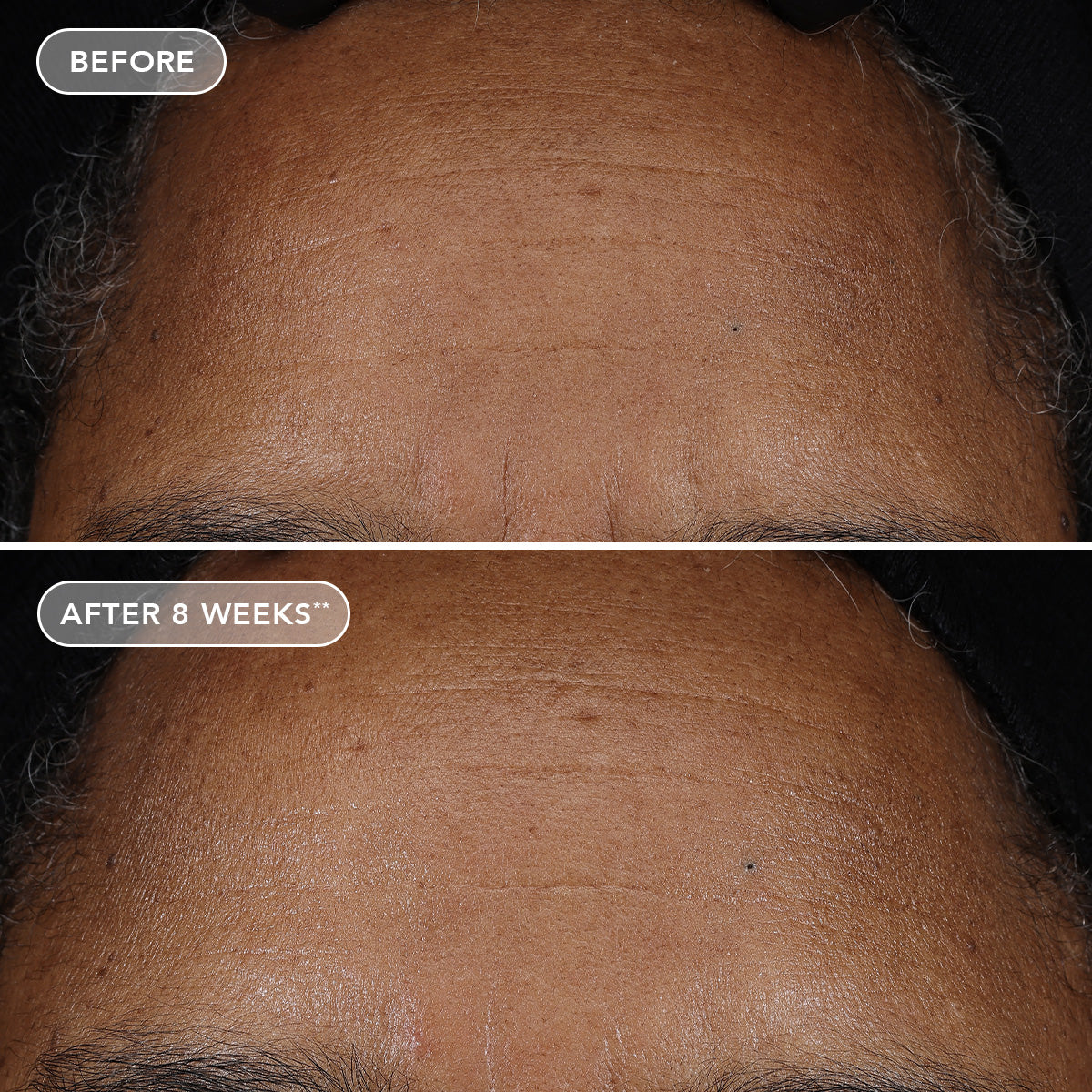 AGELESS+ retinol pure liquid retinol 0.75% (travel-size)