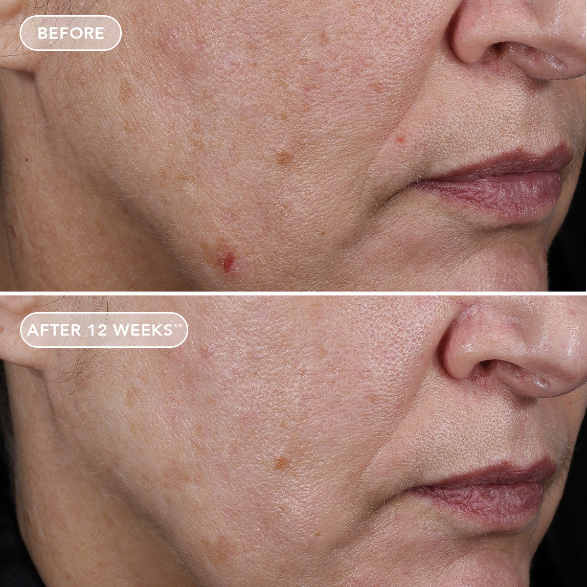 AGELESS+ retinol pure liquid retinol 0.75% (travel-size)