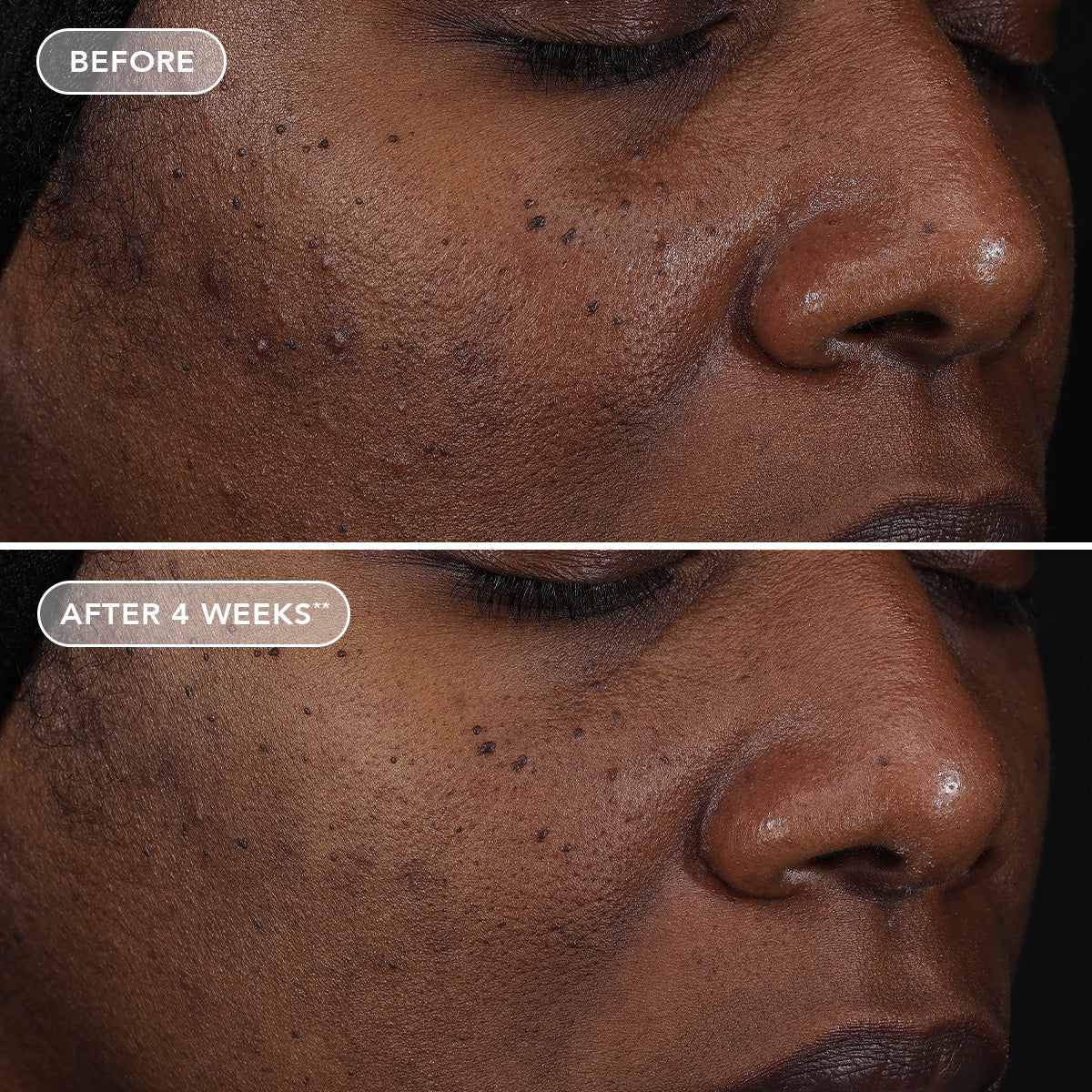 AGELESS+ retinol repair crème 0.3% retinol complex (travel-size)