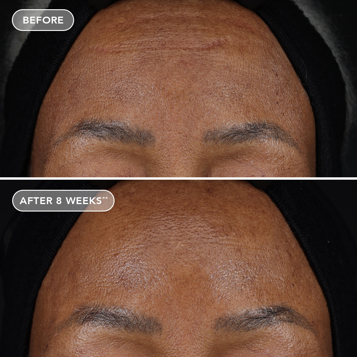 AGELESS+ retinol treatment crème 1.2% retinol complex (travel-size)