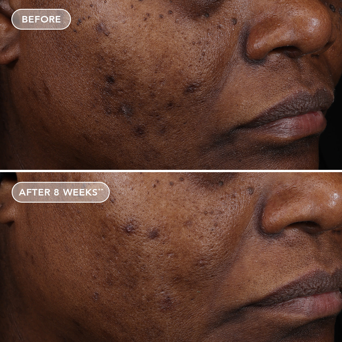AGELESS+ retinol treatment crème 1.2% retinol complex (travel-size)