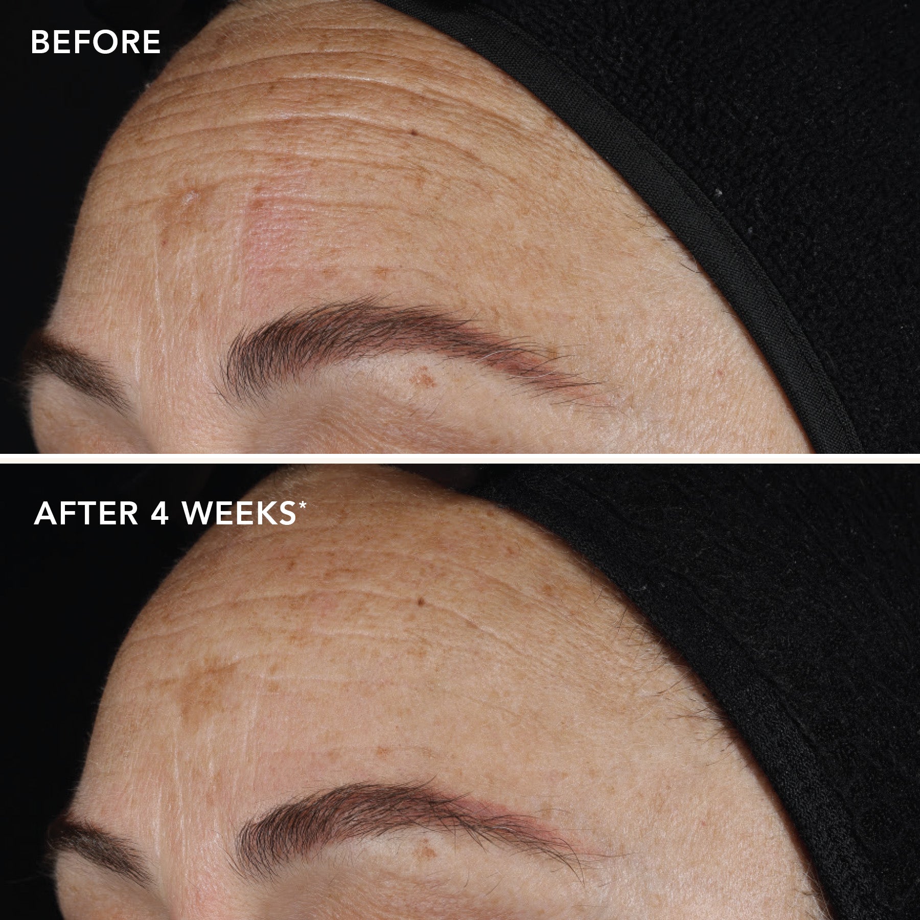 AGELESS+ retinol pure liquid retinol 0.1% (travel-size)