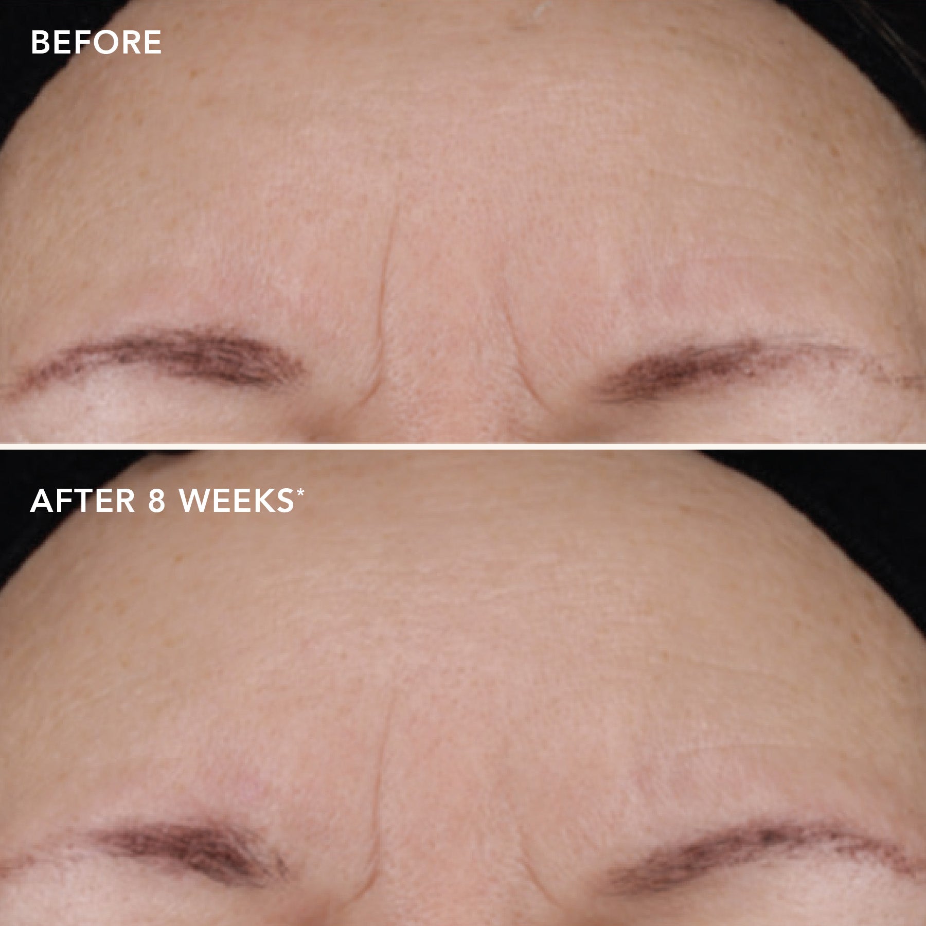 AGELESS+ retinol treatment crème 1.2% retinol complex (travel-size)