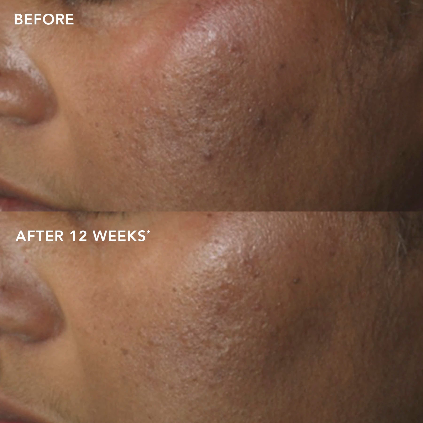 IMAGE MD® restoring power C serum