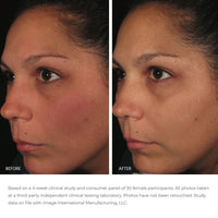 ORMEDIC® balancing antioxidant serum